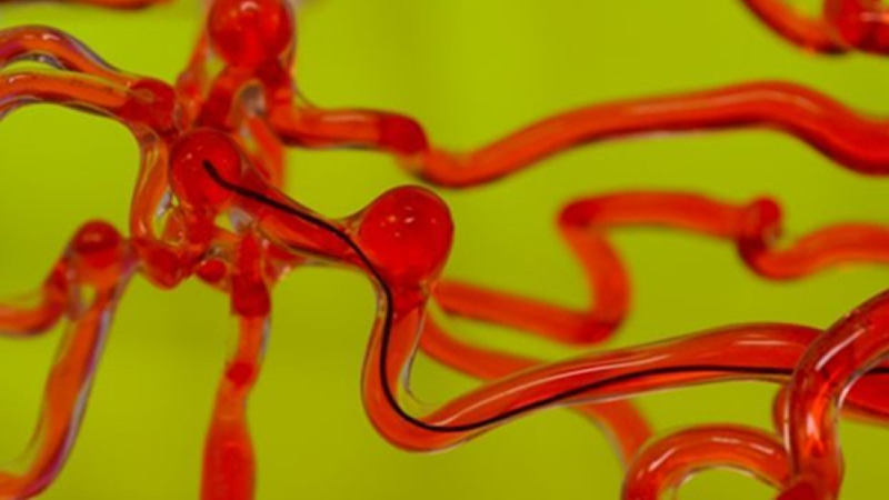 麻省理工開發磁控線性機器人，能在腦血管中自由穿梭